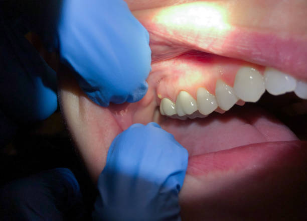 Best Pediatric Emergency Dentist in South Miami, FL