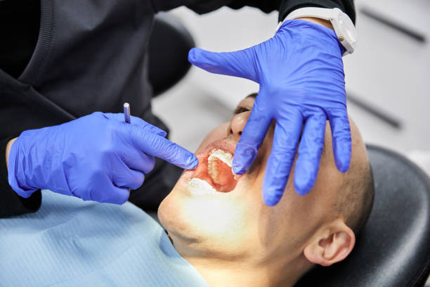 Best Emergency Gum Treatment in South Miami, FL